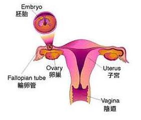 什么原因会导致女性卵巢性不孕